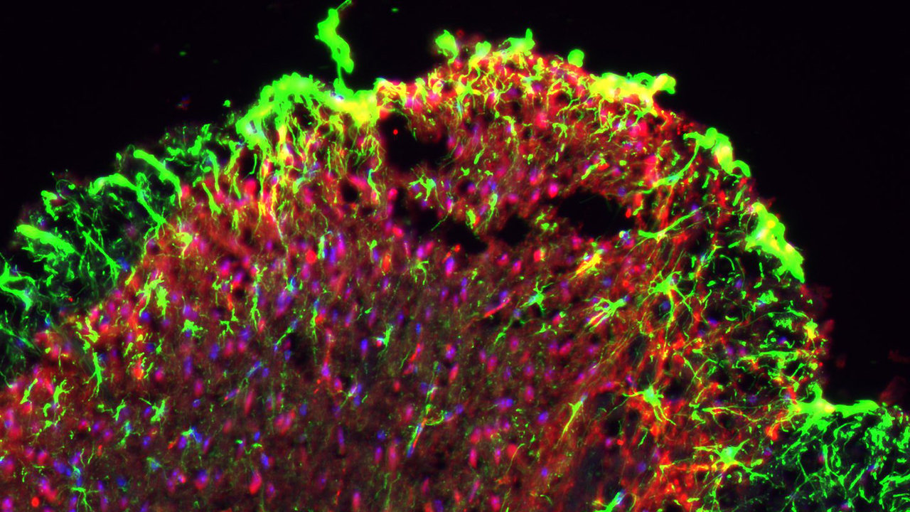 Astrocytes (green) in the dorsal horn of the spinal cord